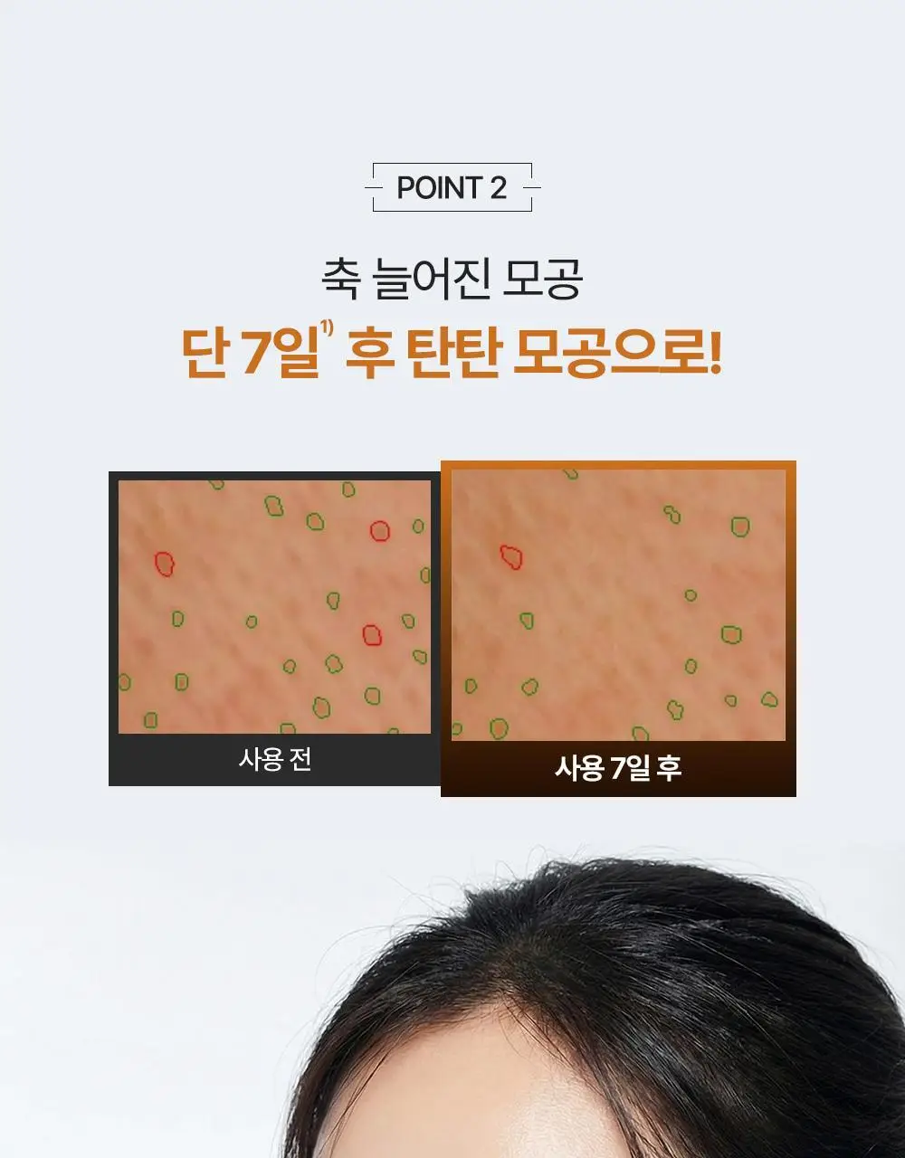 [박지현 PICK/7일 모공개선] 피캄 레티놀라겐 앰플 30ml 상세페이지 21